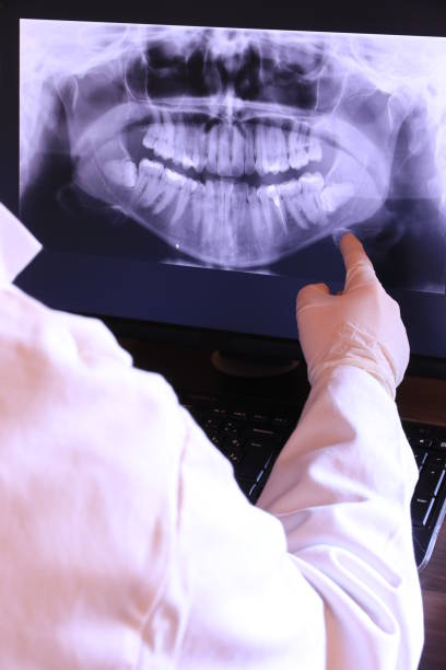 Best Emergency Tooth Extraction  in Alderton, WA