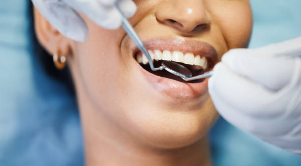 Best Dentist for Tooth Abscess  in Alderton, WA