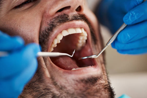 Emergency Gum Pain Relief in WA
