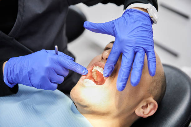 Best Cracked Tooth Emergency Dentist  in Alderton, WA